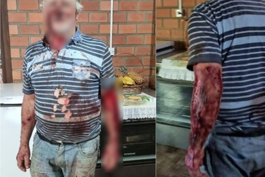 Homem é atacado por leão baio no interior de Maquiné